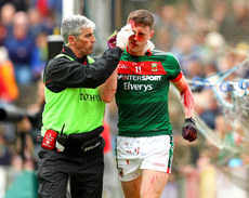 Diarmuid O'Connor with a blood injury 21/5/2017